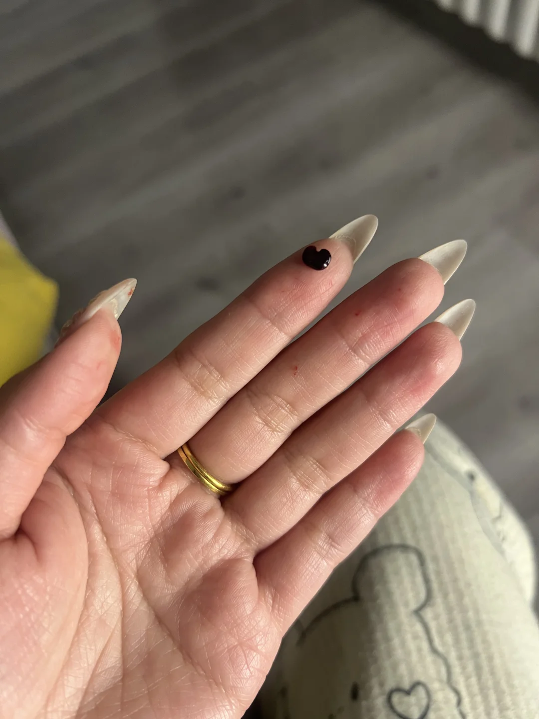 麦粒肿从眼睛里掉出来了？？？