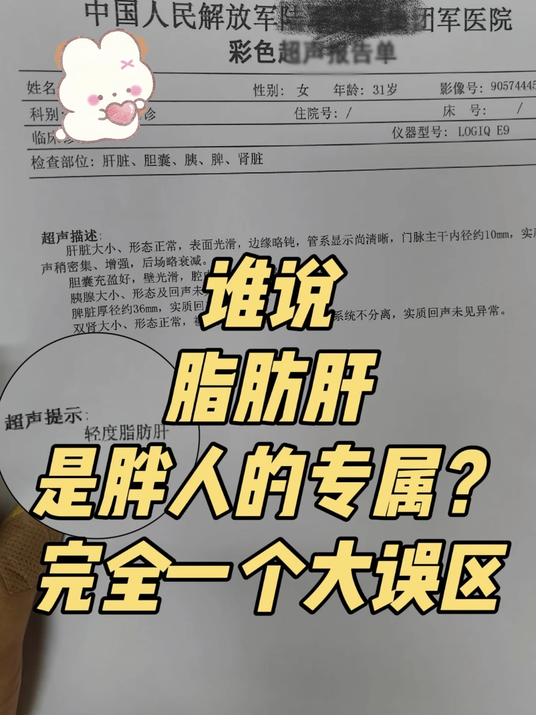 谁说脂肪肝是胖人的专属❓完全一个大误区🧐