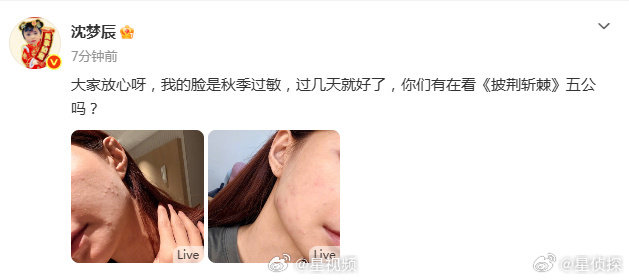 #沈梦辰回应脸上过敏# 沈梦辰回应脸上过敏让我明白，再好的皮肤也怕换季折腾。 ​