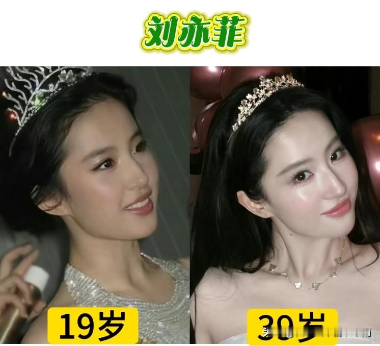 你觉得，刘亦菲在20年的光阴流转中，她的容颜发生了多大的变化呢？

​19岁的刘亦菲美的清纯灵动、仙气飘飘，39岁的刘亦菲，气质优雅、魅力依旧。

​刘亦菲的容颜无可挑剔、演技出众、生活富足，几乎没有短板。

​唯一让人感到美中不足的是，39岁的她至今仍然单身一人。

你说刘亦菲条件那么好，什么样的
