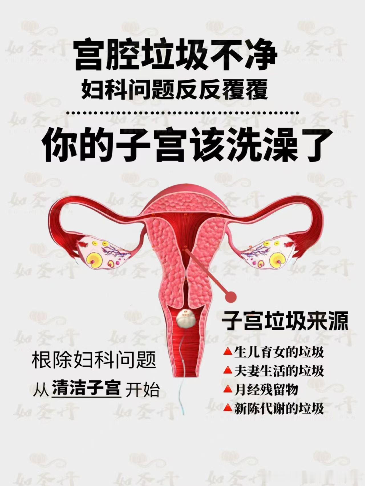 #生活手记#【为什么要用如圣丹？】
子宫排毒是女人妇科健康、延缓衰老的根本！
没有一个成年女人的子宫是没有垃圾毒素的…

1️⃣每月大姨妈的经期残留
2️⃣性生活残留的精子垃圾
3️⃣生产及流产残留的恶露
4️⃣身体产生新陈代谢垃圾
5️⃣大环境的食物环境污染．.

这些都是子宫垃圾毒素来源的途径 ​