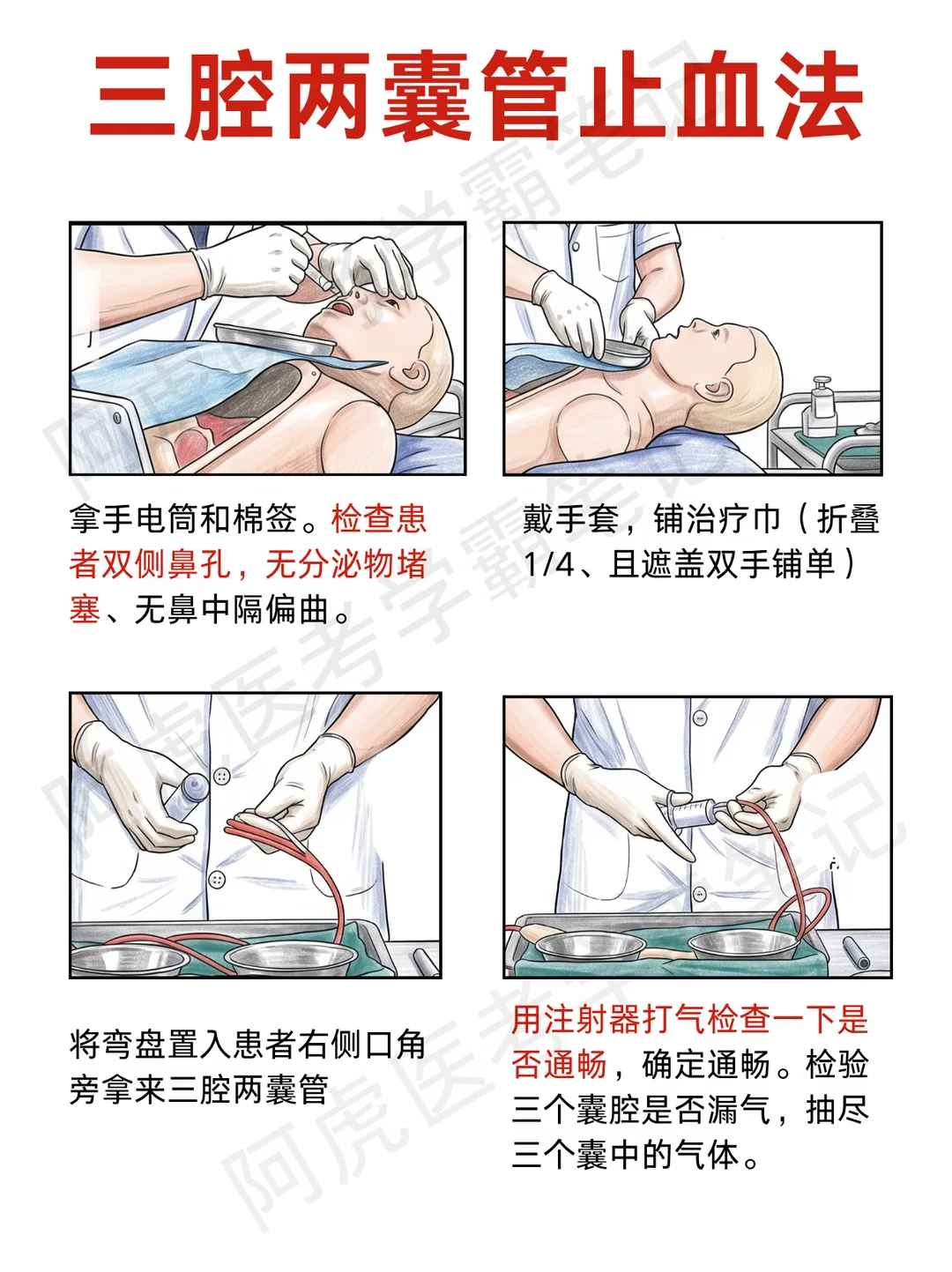 阿虎医考技能笔记📚|三腔两囊管止血👆