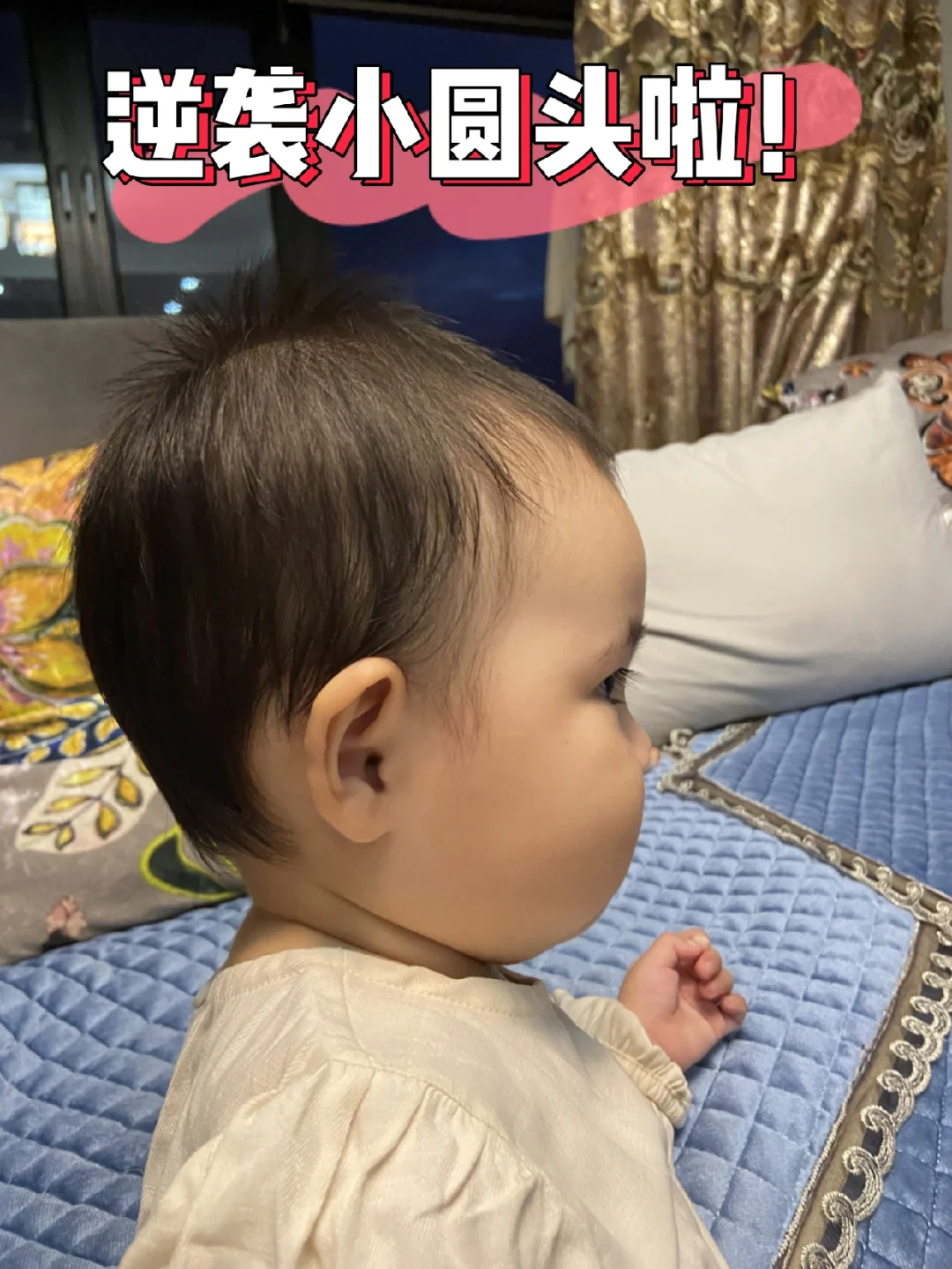 ❤️接小圆头啦！成功逆袭翻盘的双眼皮！