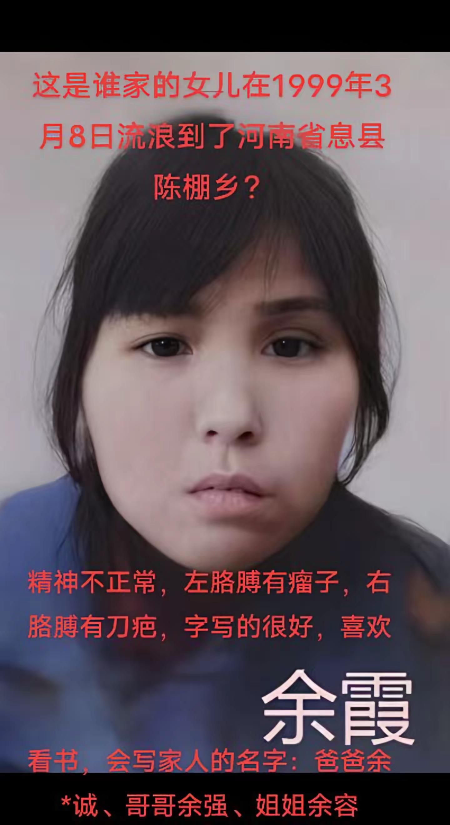 寻家。约1975年出生1999年流落到河南省信阳市息县陈棚乡  余霞寻家人636013宝贝回家 宝贝回家之万家团圆 寻亲 寻亲 河南 @dou来寻人 @寻人 @Dou来寻人