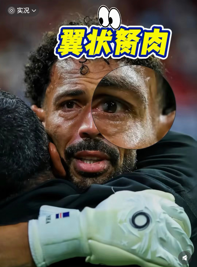 科普一下，眼部胬肉是小问题，眼科小手术就可以解决 不过佛得角门将比赛完...