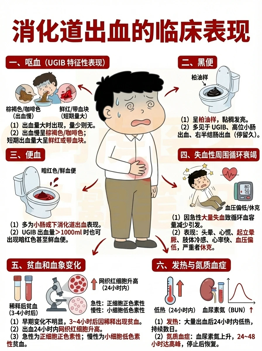 阿虎医考笔记：消化道出血的临床表现❓