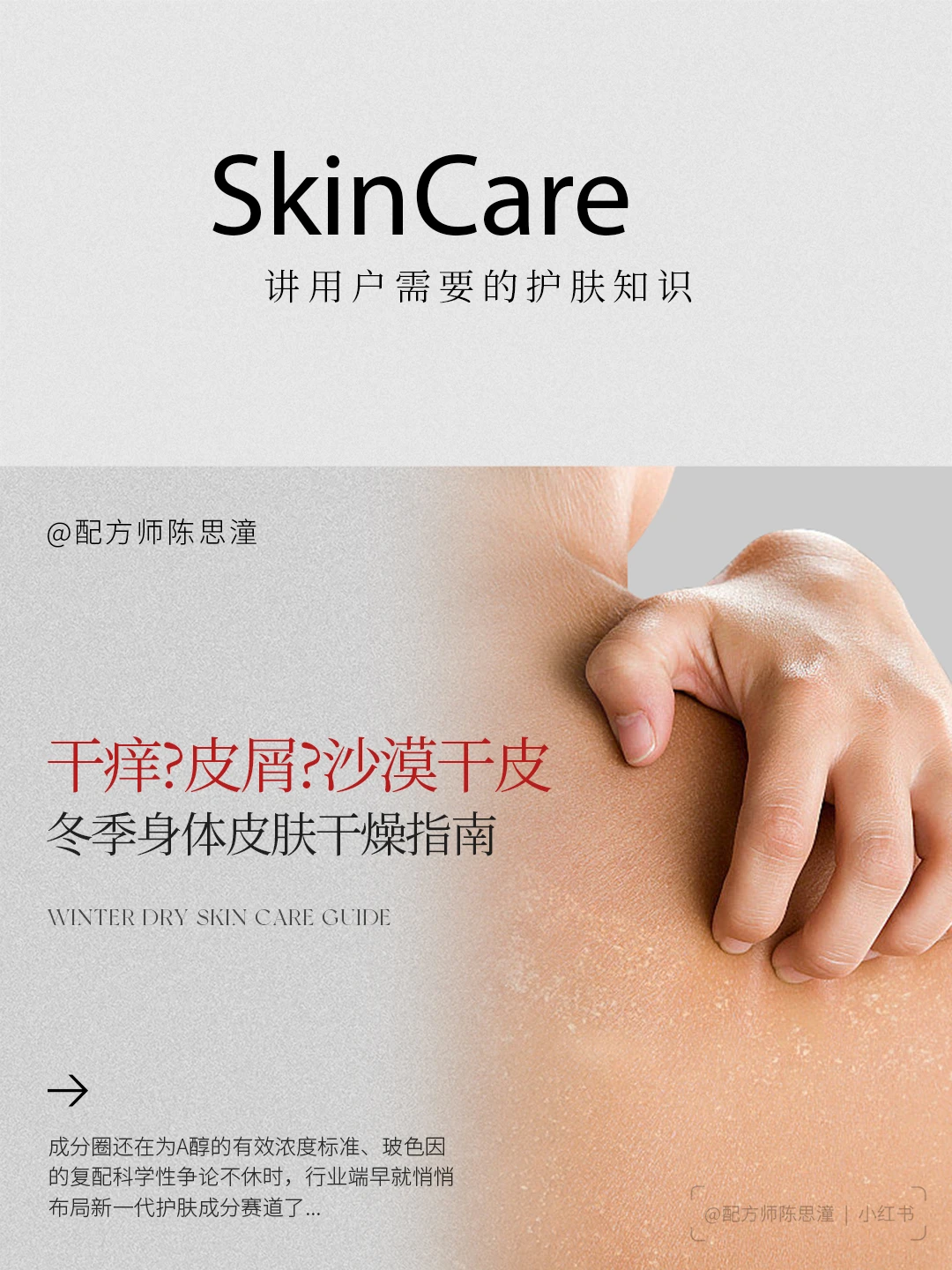 护肤知识｜皮肤越冷越干，如何处理和预防？