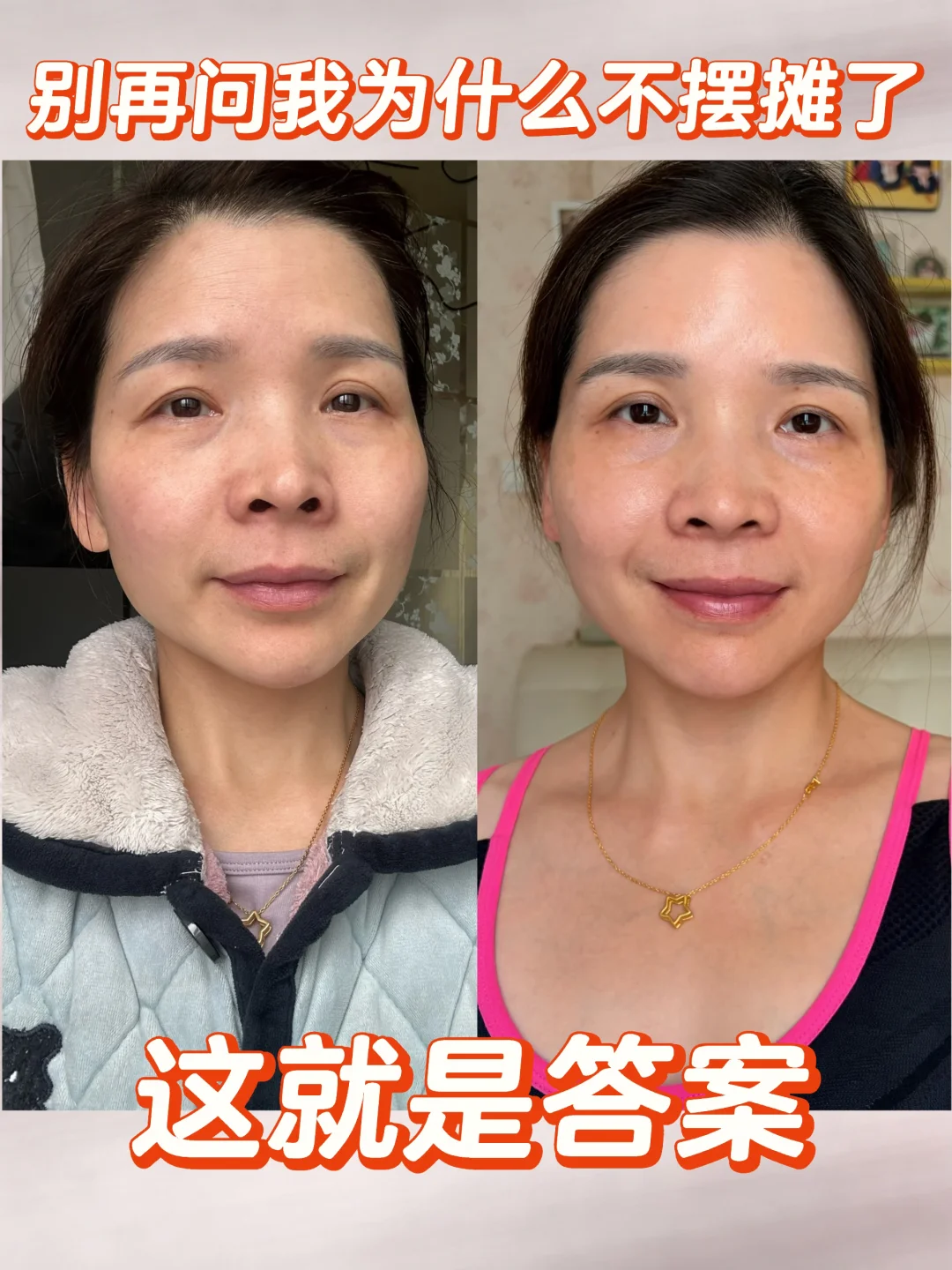 左边是3月份，那时候虽然休息一个多月了，但身体还是疲惫，状态也很不好。...