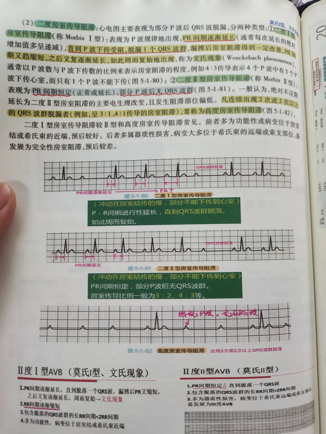 医学生规培笔记心电图学习