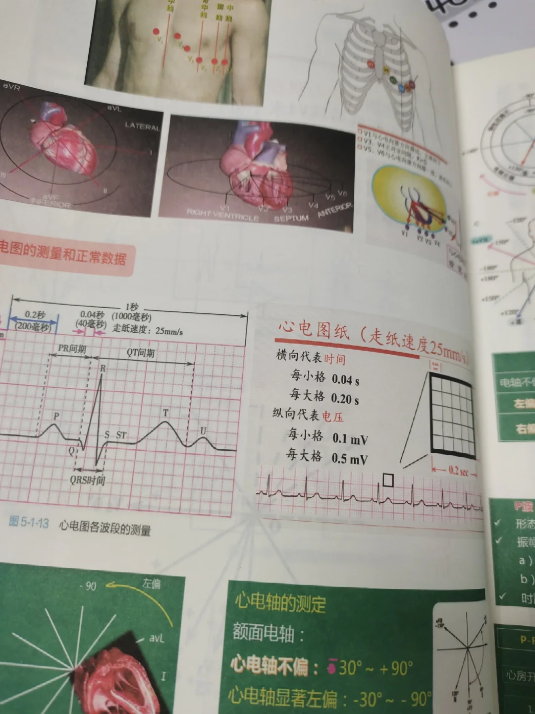 纸质心电图笔记本干货