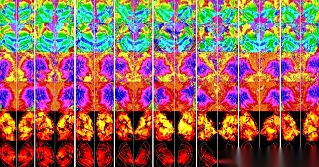 以色列魏茨曼科学研究所的米哈尔·伊拉尼团队，用人工智能工具分析八名受试者的脑部扫描数据，直接复原出了他们眼睛正在看的画面。
这项在国际学习表征会议上亮相的技术，目前只能读取眼睛捕捉到的视觉图像，还读不出脑子里虚构的念头。
目前这套系统的技术验证还卡在降低错认率上，比如它曾把图片里泡在浴缸里的狗还原成