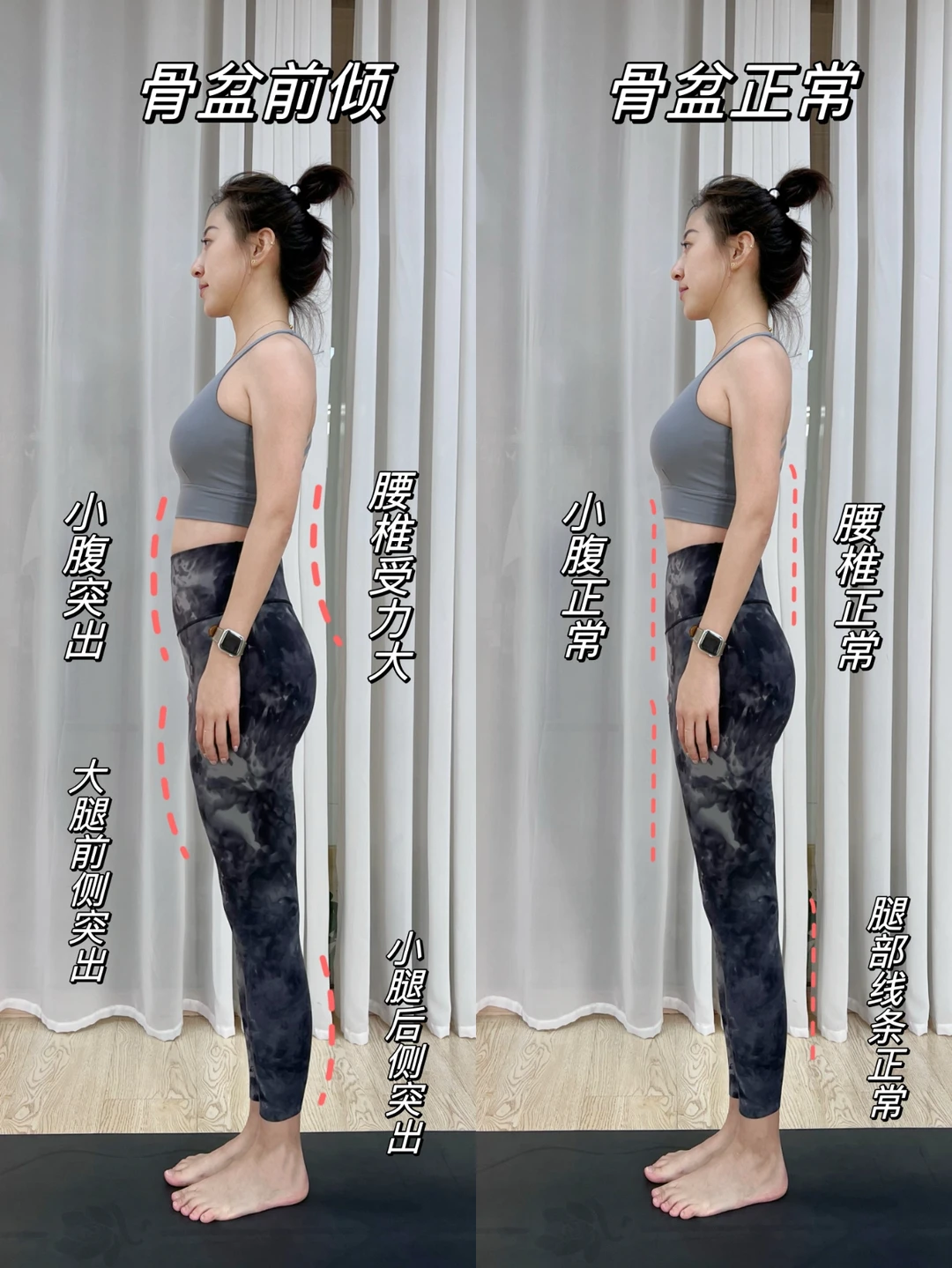 牛哇!6个动作改善骨盆前倾!缓解腰肌劳损