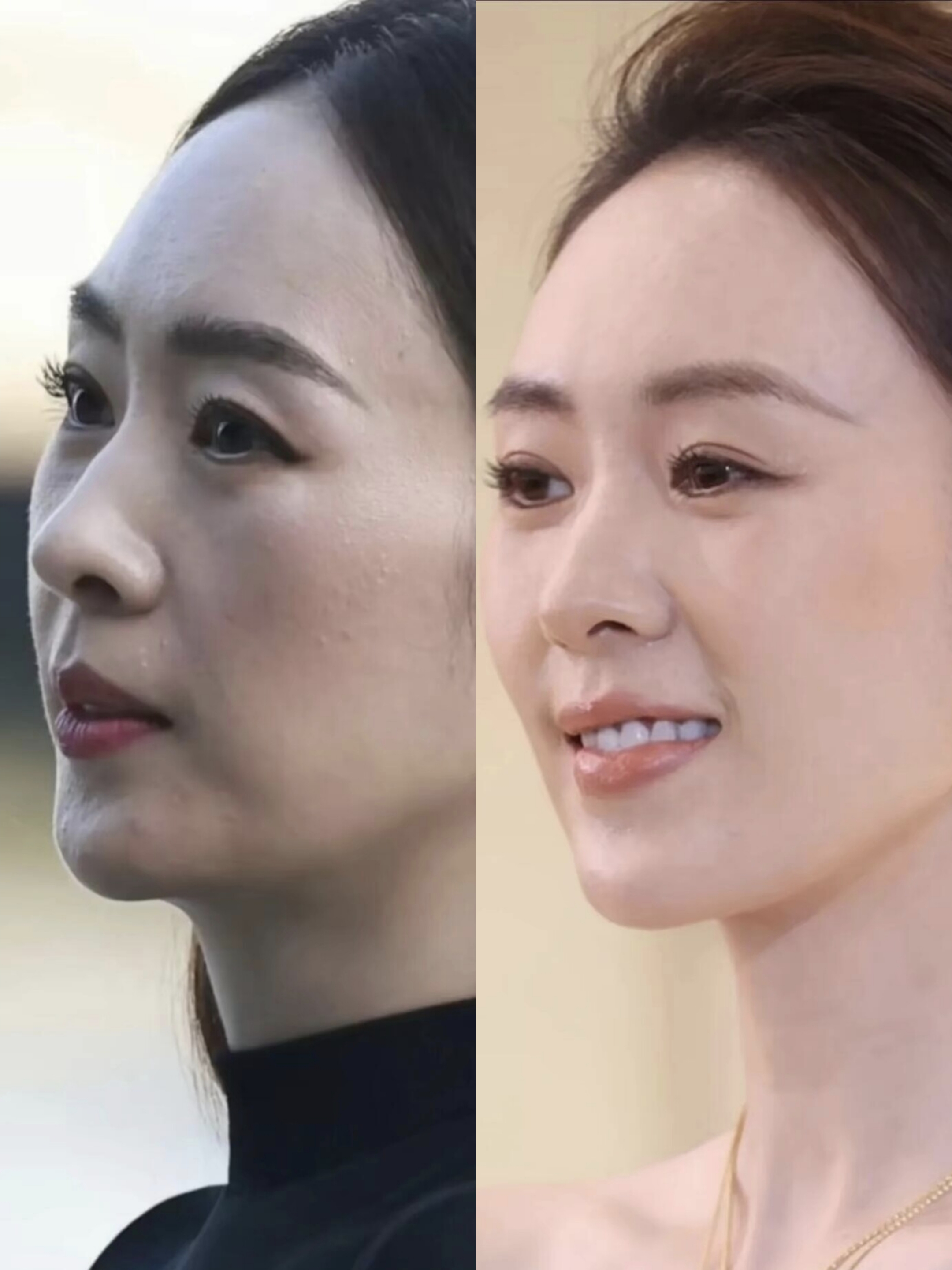 41岁女星童瑶，美颜前后的对比，清纯和性感之间，你更喜欢哪一款？