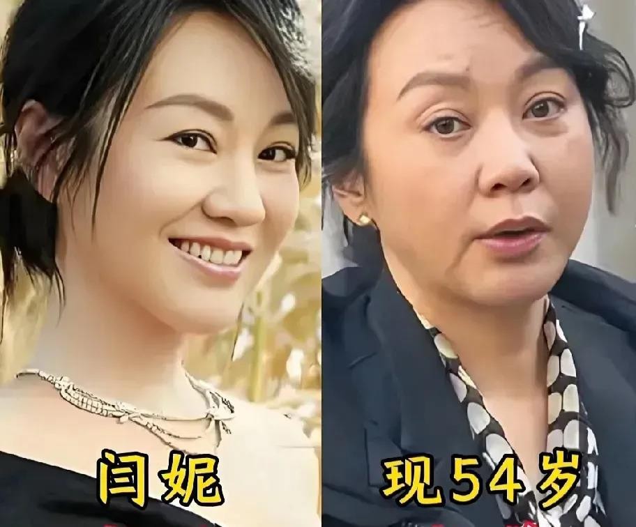素颜的陈乔恩、素颜的闫妮、素颜的江疏影，这几位最近都挺大方，直接把没化妆的脸晒出来了。陈乔恩那张我看了，黑眼圈挂着，眼皮有点浮，眉毛淡得快看不见，跟荧幕上那个精致明艳的她确实反差挺大，但脸型还是顺的，五官底子在那一摆，怎么都不会难看。她没刻意修图，也没找角度遮遮掩掩，连法令纹都大大方方露着。说实话，