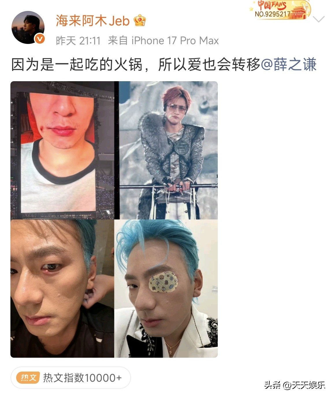 海来阿木与薛之谦聚餐，薛之谦意外中招！