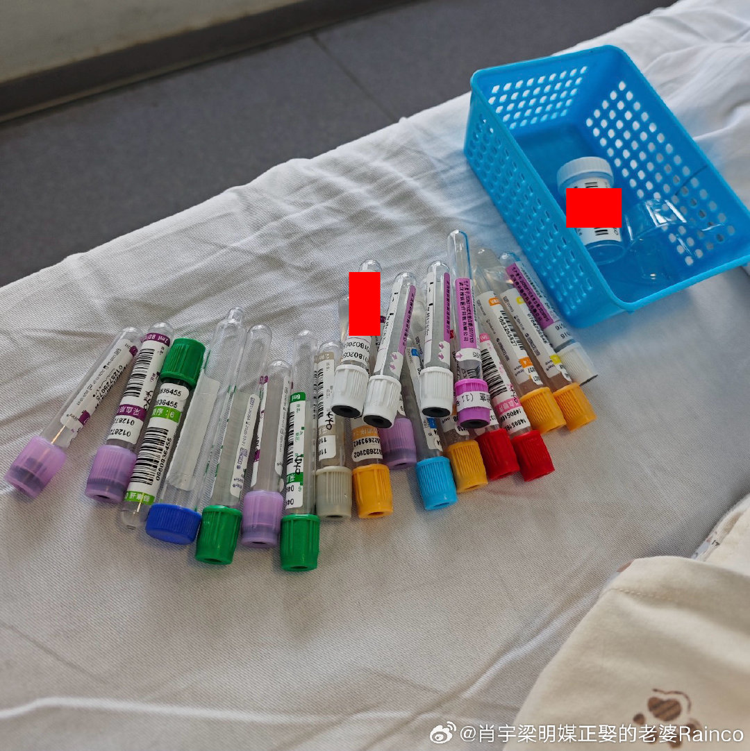 #摩登兄弟[超话]#  哥， 妈耶，杀了我得了，就问有哪个好人家一次抽这么多20多管血的，本来就重度贫血，内脏出血，却还要被抽这么多管，是不是知道我是RH阴性血，所以就多抽点，好拿去卖啊！直接把我的血抽干得了，真是的，输的血还没抽的血快[笑cry][笑cry][笑cry]
​