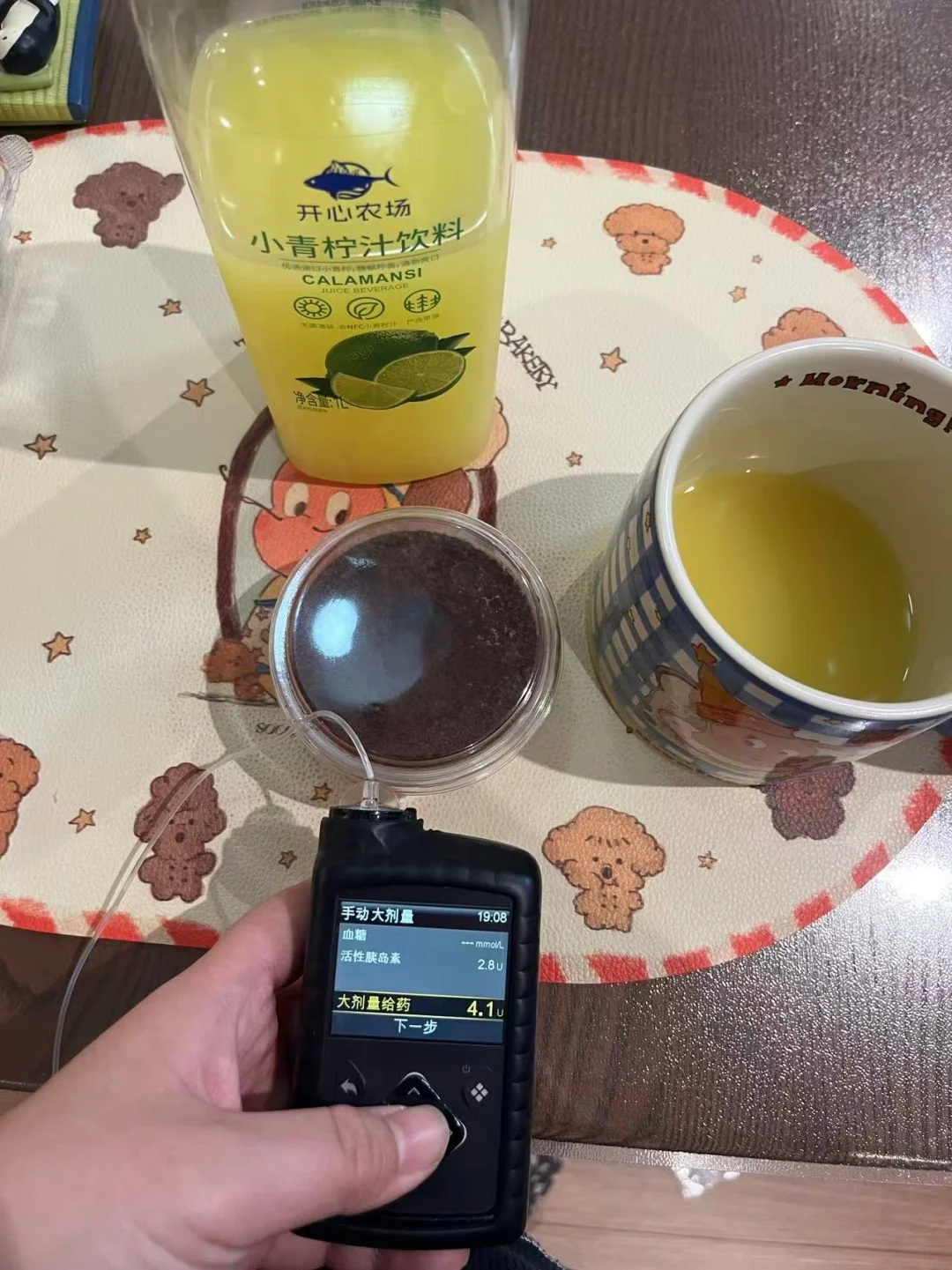 买泵三年来我的控糖心得