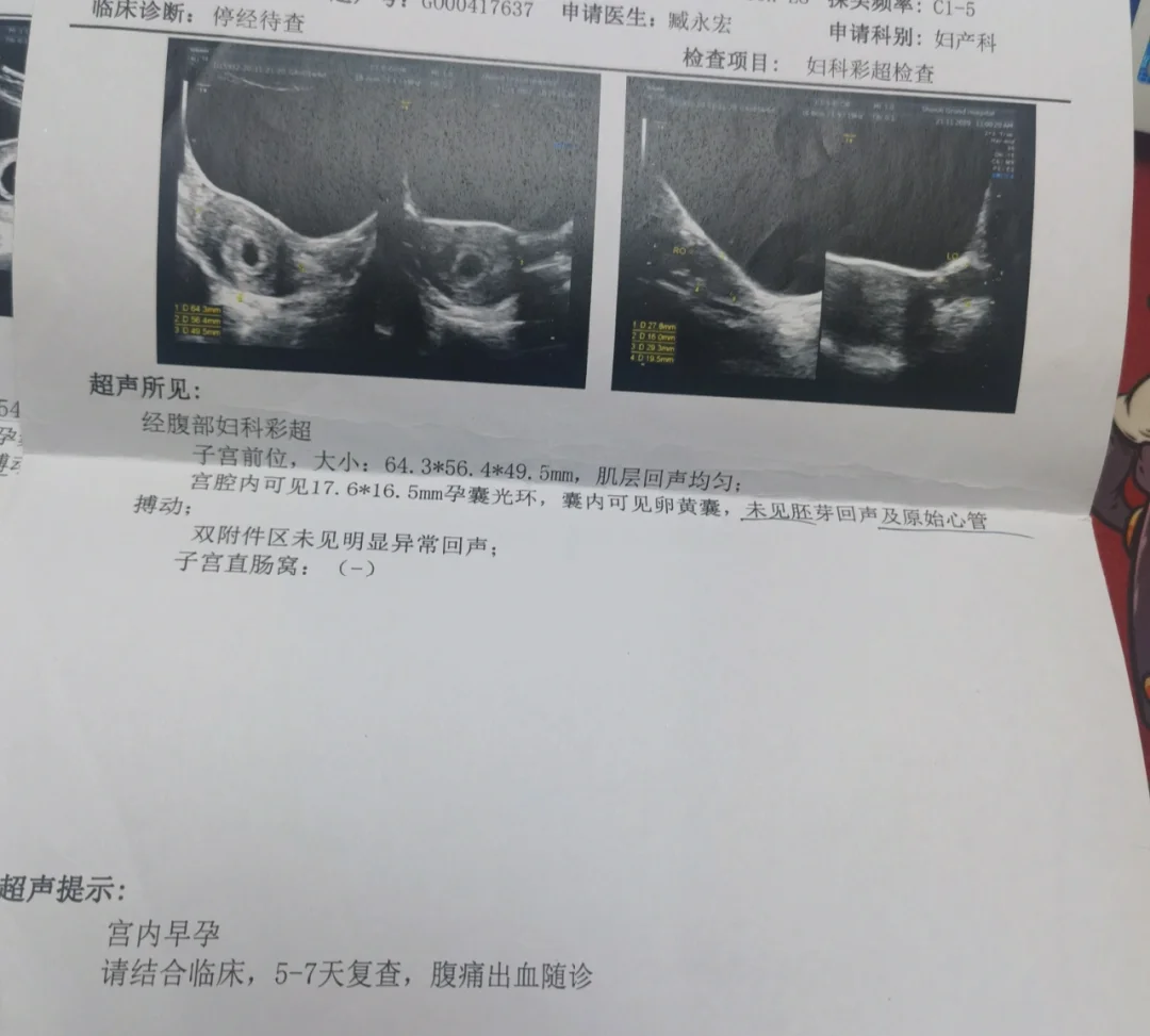 孕6周匆匆去医院检查，被告知孕8周再来