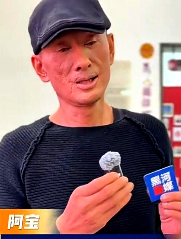 久未露面的歌手阿宝近日在黑龙江黑河的群众文艺大赛上现身，却因面部变化成为焦点。
 

57岁的他嘴角有一道显眼印记，面部纹路僵硬，引发网友对“烧伤说”和“医美说”的广泛猜测。
 

镜头扫过去的时候，底下不少人甚至没敢第一时间相认。
 

当年头上扎白毛巾、身披羊皮坎肩的标志性模样早没了，取而代之的