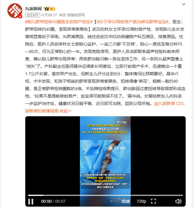 #女子孕32周剖宫产救出麻花脐带宝宝#武汉的林女士怀孕32周时，产检发现胎儿发育明显滞后，住院后三次胎心监护都不合格，胎心一度降到正常数值的一半。

医生紧急排查发现脐带扭转四十圈，当即实施剖宫产，顺利娩出的早产女婴目前恢复良好，很快就能出院回到父母身边。 ​