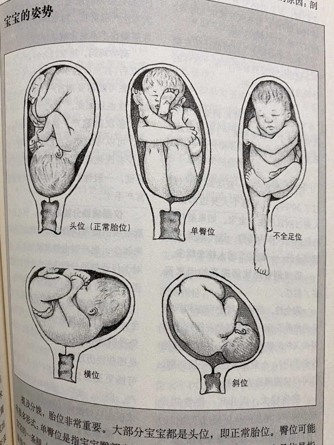 顺产分娩全过程附图‼️看完你就没那么害怕了