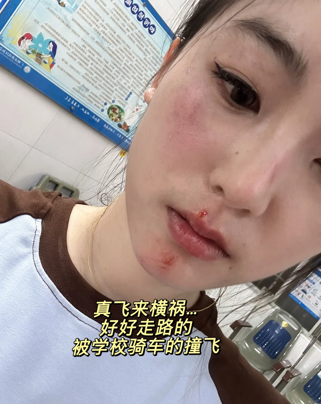 真飞来横祸，好好走路的，被学校骑车的撞飞…