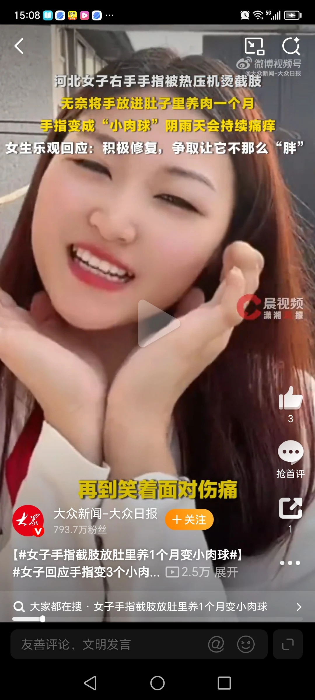 女子手指截肢放肚里养1个月变小肉球，医生