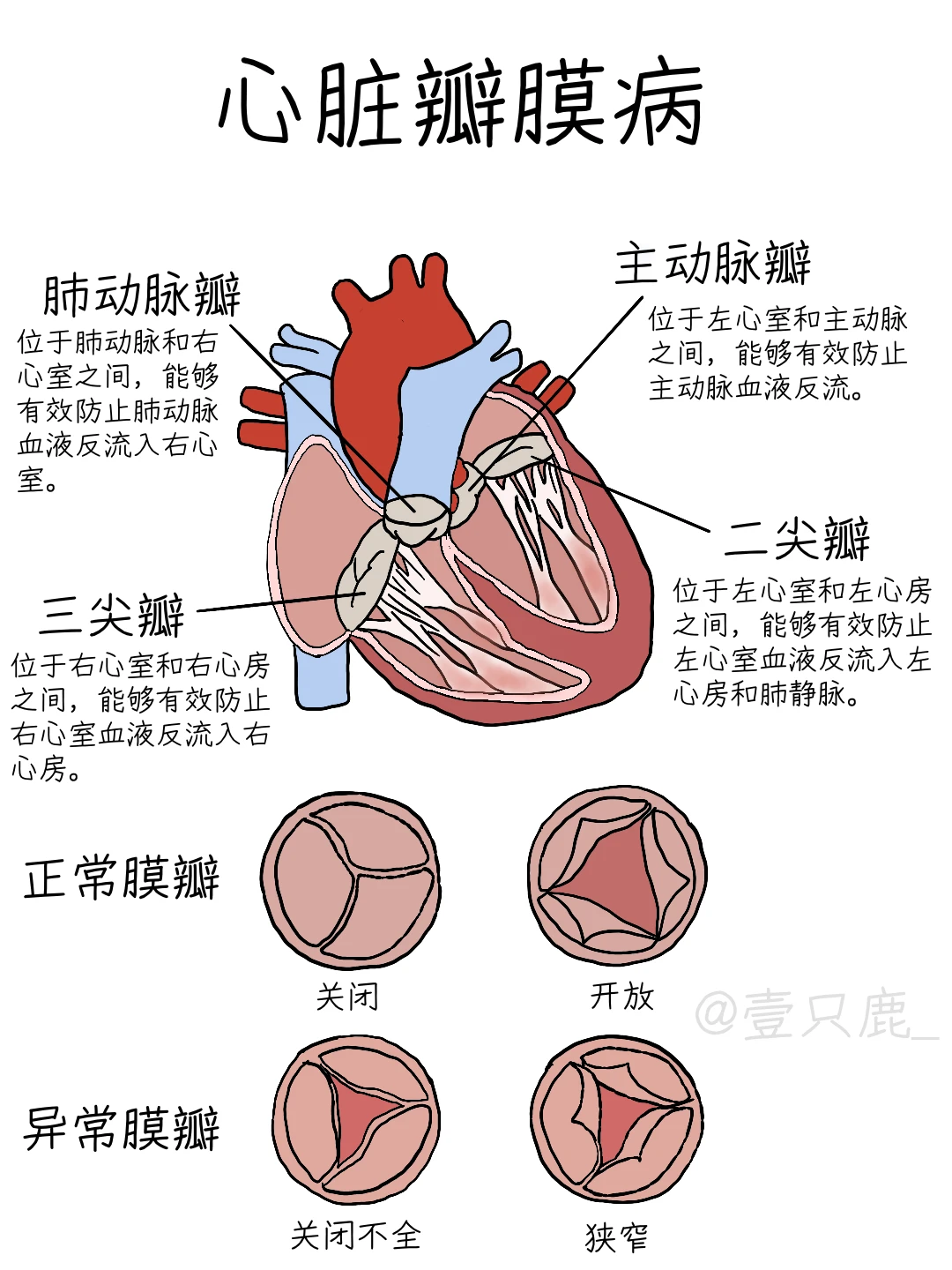 医学生笔记📝｜心脏瓣膜病