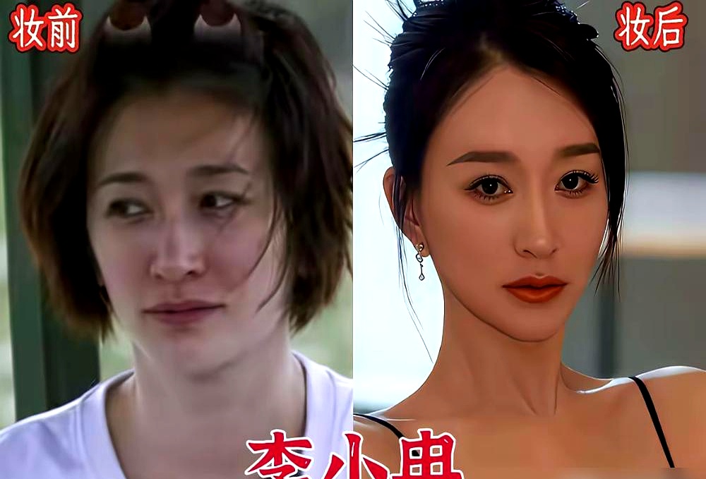 真正扛老的从来不是什么天价面霜，修图师的手艺才是永恒的神
 

戚薇直播直接掀了底牌，大方承认肉毒打太多导致眉毛都动不了
 

秦岚也是直言不讳，坦荡承认靠打针来维持状态
 

景甜更惨，埋线双眼皮直接翻车，顶着悲伤蛙的样子去修复
 

高清镜头下根本藏不住秘密，动过刀的笑起来肌肉走向全露馅