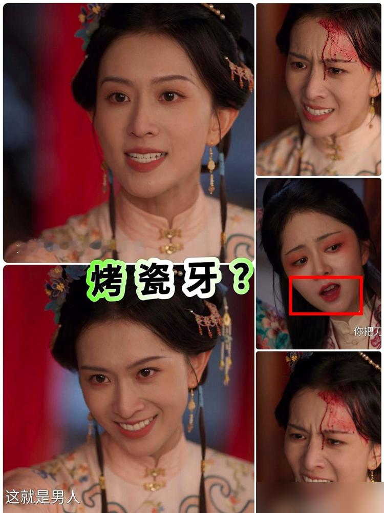 一口牙毁了一整部戏，这女配拔剑冷笑的时候，我眼睛根本离不开她嘴里那排夜光砖。
《兰香如故》里郑蔓宜这个角色，设定是蛇蝎美人，又狠又魅。结果演员嘉泽一开口，满嘴烤瓷牙白得发蓝，又大又饱满，嘴唇使劲都包不住。拍黑天戏都不用打光，那牙自己会亮。
最出戏的是情绪爆发戏。她在那冷笑、放狠话，本来看眼神挺入