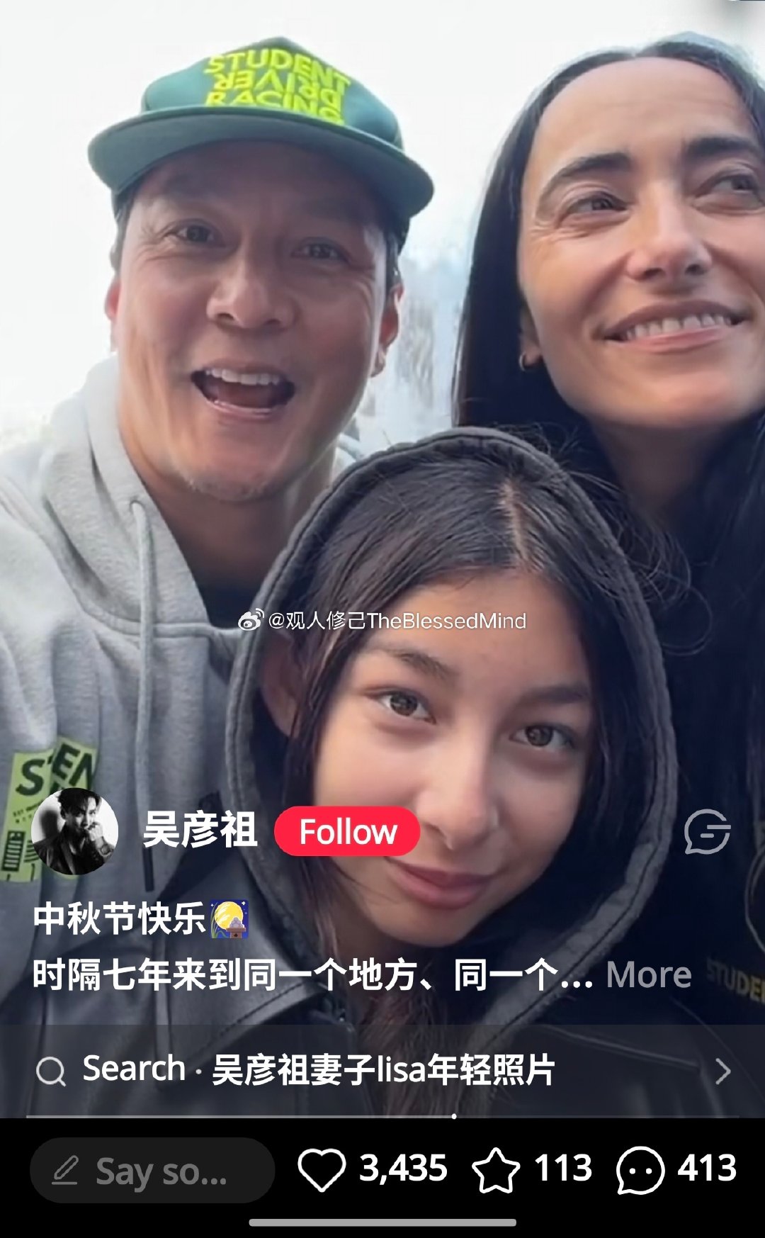 老外是真喜欢拍一脸褶子，一点滤镜也不加，非常松弛了 ​