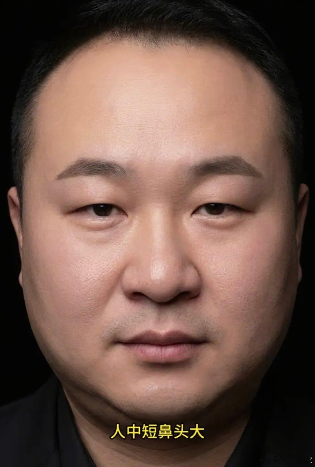 富态脸，没钱命，都是鼻头大、人中短惹的祸 生活里有一种很有意思的现象：有些人第一眼看上去，自带贵气，脸型圆润柔和，五官舒展，看着就像衣食无忧、不用辛苦奔波的富太相。可深入接触之后才发现，日子并不宽裕，求财多阻碍，看着有福，却很难守住财。老祖宗在识人相理里，把这种格局总结为一句话：富太脸，没钱命，多是鼻头大，人中短所致。      很多人误以为，鼻头大就是聚财，其实这句话要分条件，不能单独拿出来定论。鼻头为财帛宫，主一个人的财运、花钱的心态，还有守财的能力。鼻头圆润有肉，本是先天不缺衣食的底子，可如果只是单纯鼻头肥大，鼻翼收不住，财库就等于门大而关不严。这种鼻头，容易赚钱机会不少，但是花销也大。       这类人大多心软重面子，耳根偏软，亲友开口求助，很难狠心拒绝。容易被人情绑架，为家人、朋友消耗钱财。也容易冲动消费，看重外表体面，愿意在穿搭、形象上面投入资金，在外看着风光，内里常常捉襟见肘。机会摆在眼前的时候，明明可以抓住，却容易因为心软、太重人情，让利过多，最后辛苦一场，落不下...