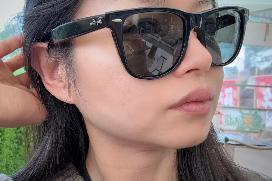 去年经历了烂脸，终于好了