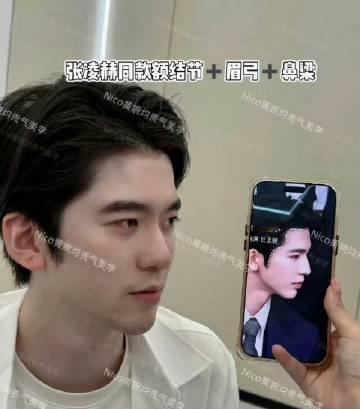 赵樱子的弟弟赵恩达因被曝以演员张凌赫为模板进行额结节、眉弓、鼻梁全套面...