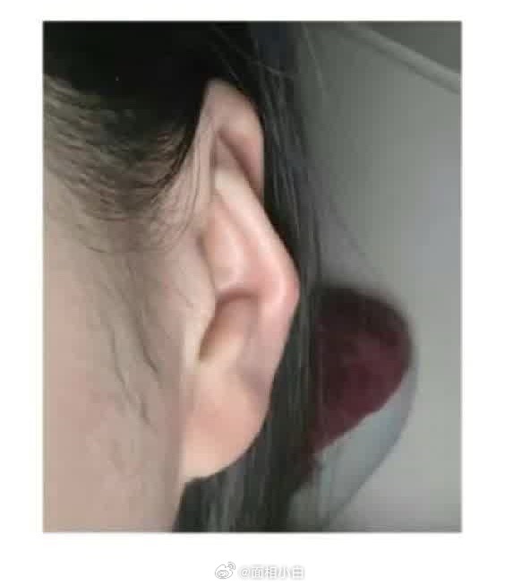 耳骨外翻+耳朵薄小的人，亲密圈层较小，兄弟姐妹、亲戚朋友都不易亲近，节假日就会感受很明显。 ​​​