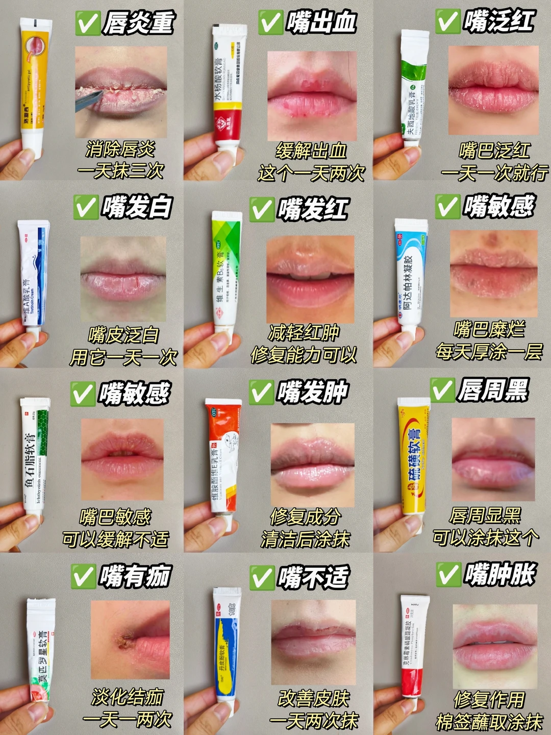 唇炎药总结篇！别犹豫直接抄作业！