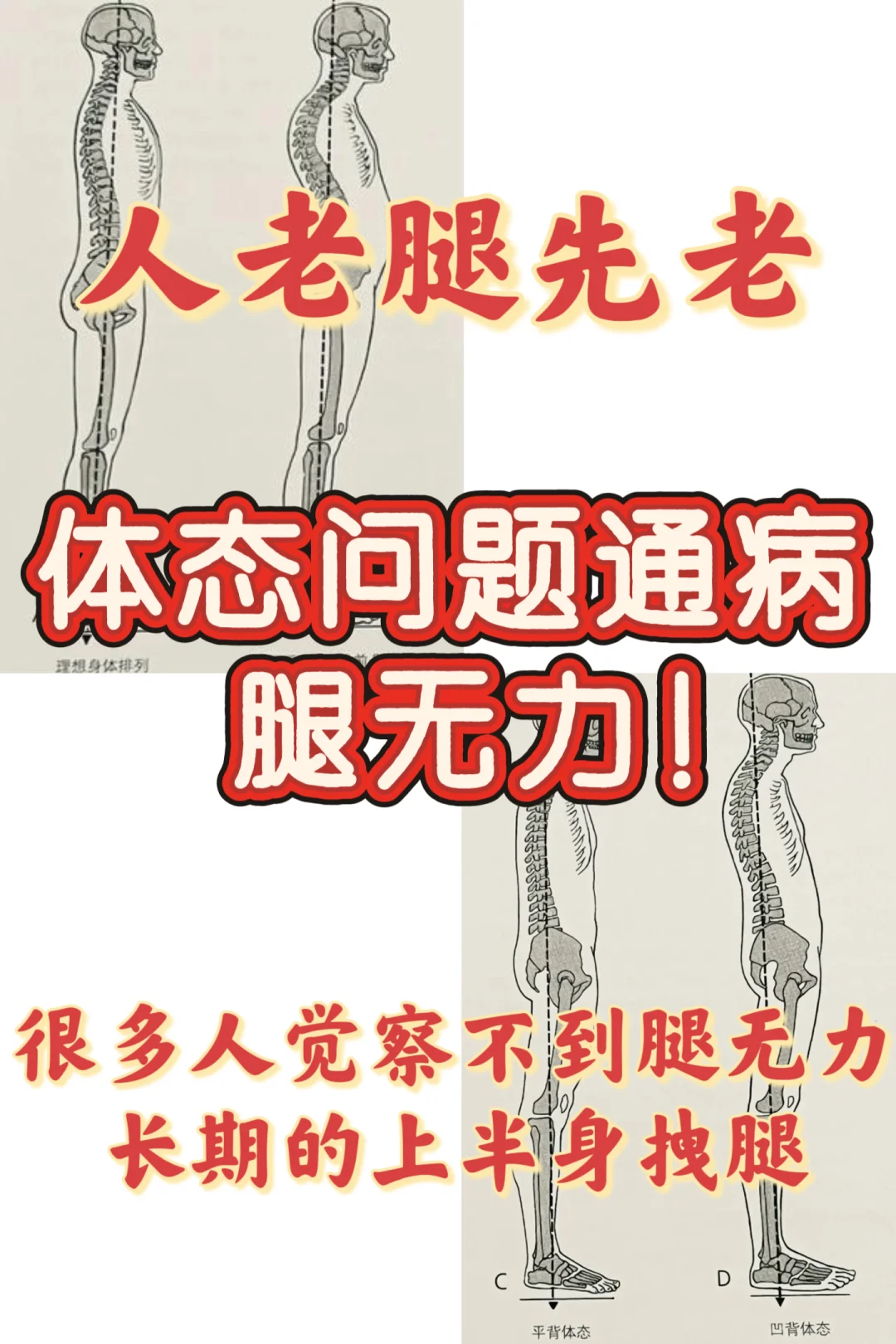 人老腿先老！体态问题通病：腿没有支撑力