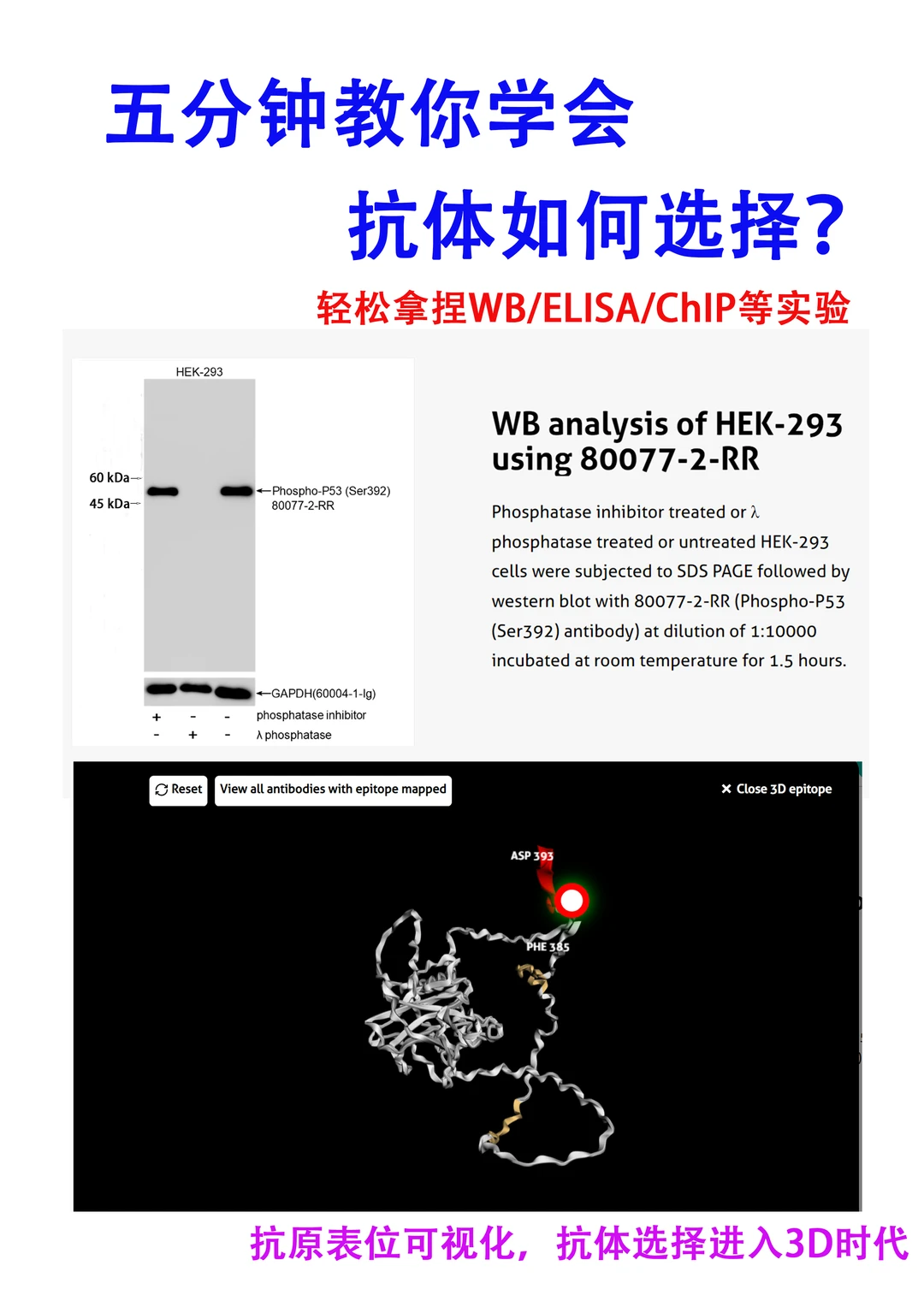 WB干货|🔥五分钟教会你如何选择抗体