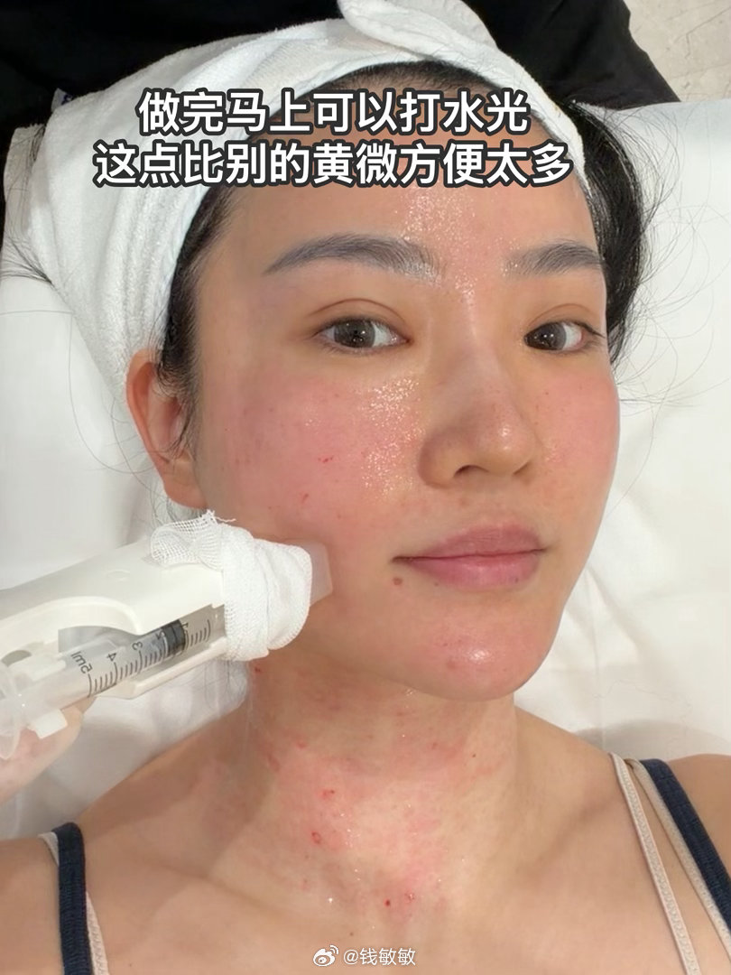 硅谷（黑曜双波） 强的可怕hhhh ​​​