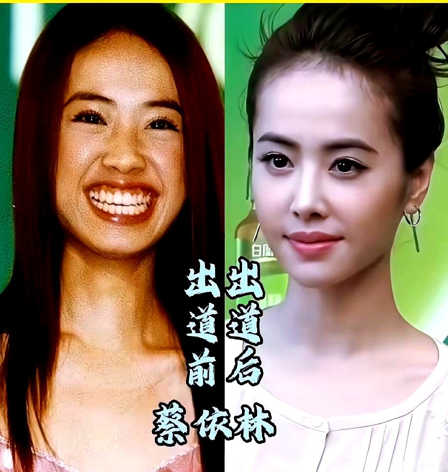 有人靠脸在热搜上挂了一辈子，有人一亮嗓子直接掀翻天花板。

张靓颖攥着麦克风往台上一站，十几年没倒过的嗓子一开口就是王炸。当年蔡依林被骂得体无完肤，硬是咬着牙在练舞房摔打，把自己逼成天后。

那个曾经缩在角落里连头都不敢抬的周深，现在捏着话筒，声音出来能把人的眼泪生生拽下来。尚雯婕死磕冷门曲风不低头