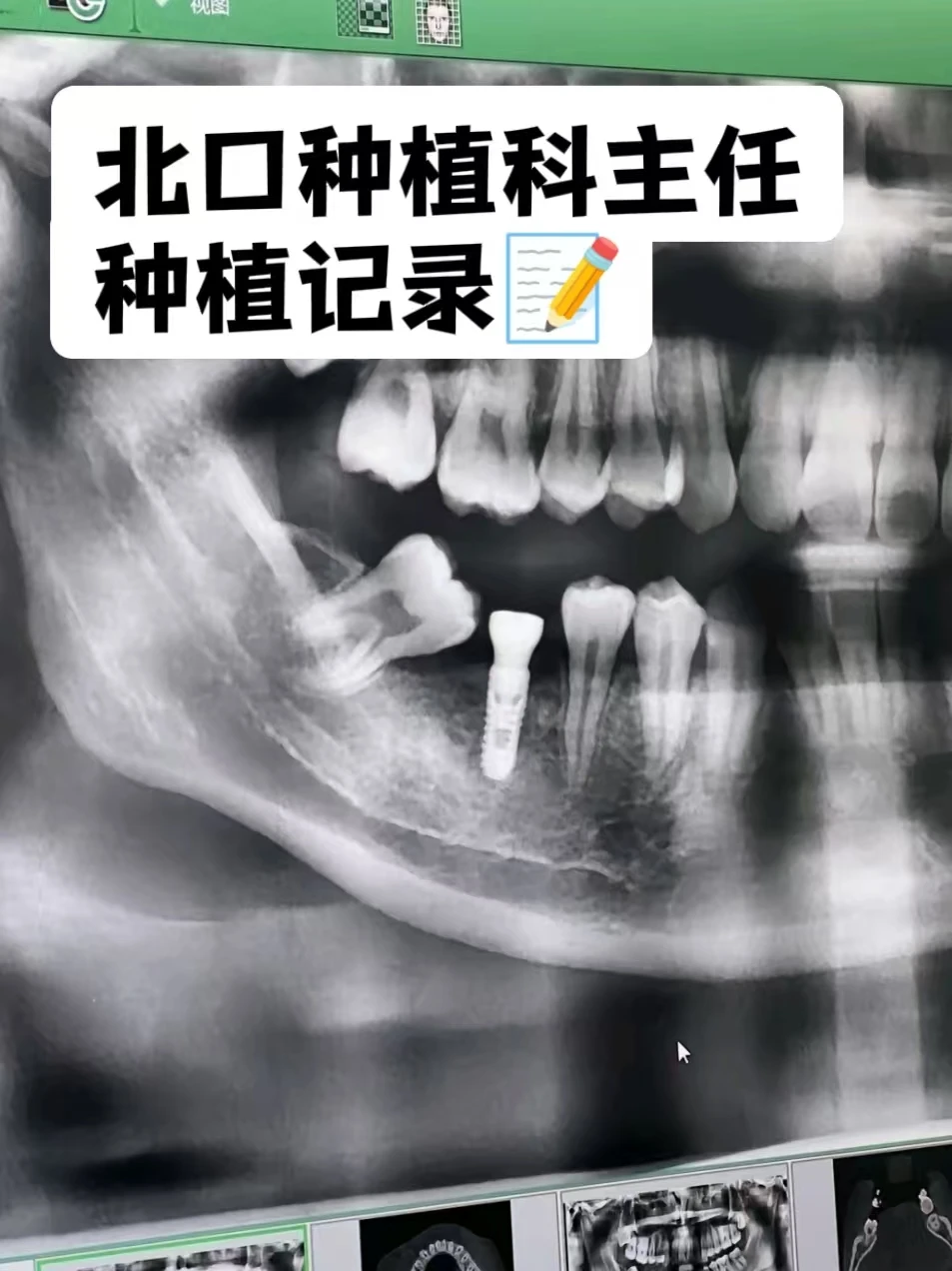 清华毕业生在北京种牙，首选还是北大！