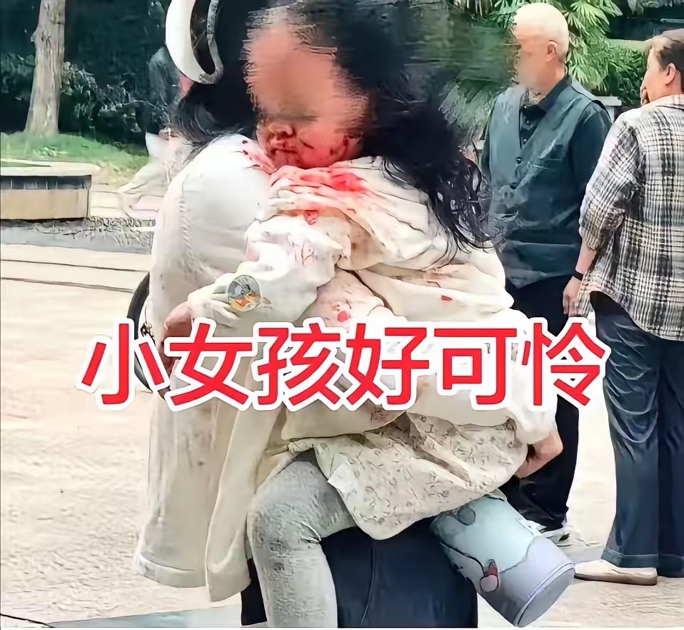 已经发生无数起惨案了，老百姓没有安全感，9月13日，四川眉山仁寿县中城国际社区内