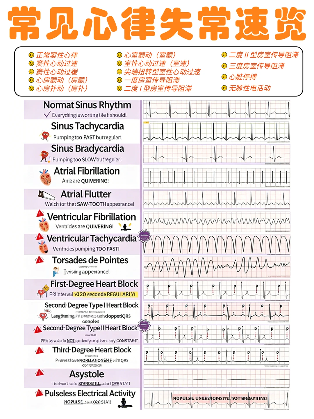 备考RN/心律失常速览！！学！！内容