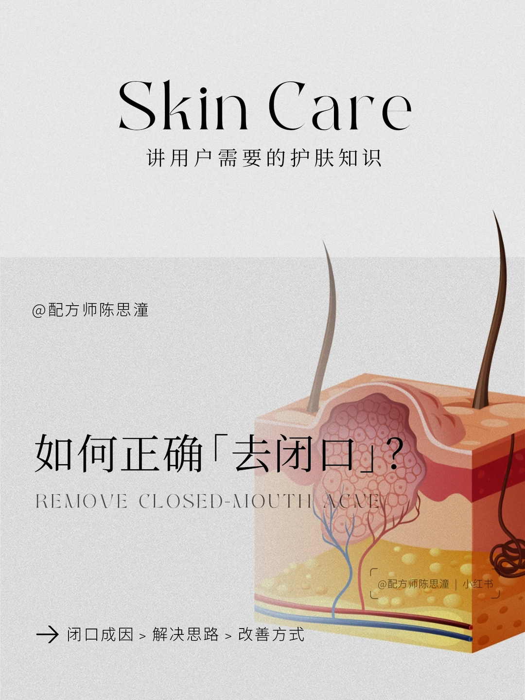 护肤知识｜新手护肤，如何正确「去闭口」？