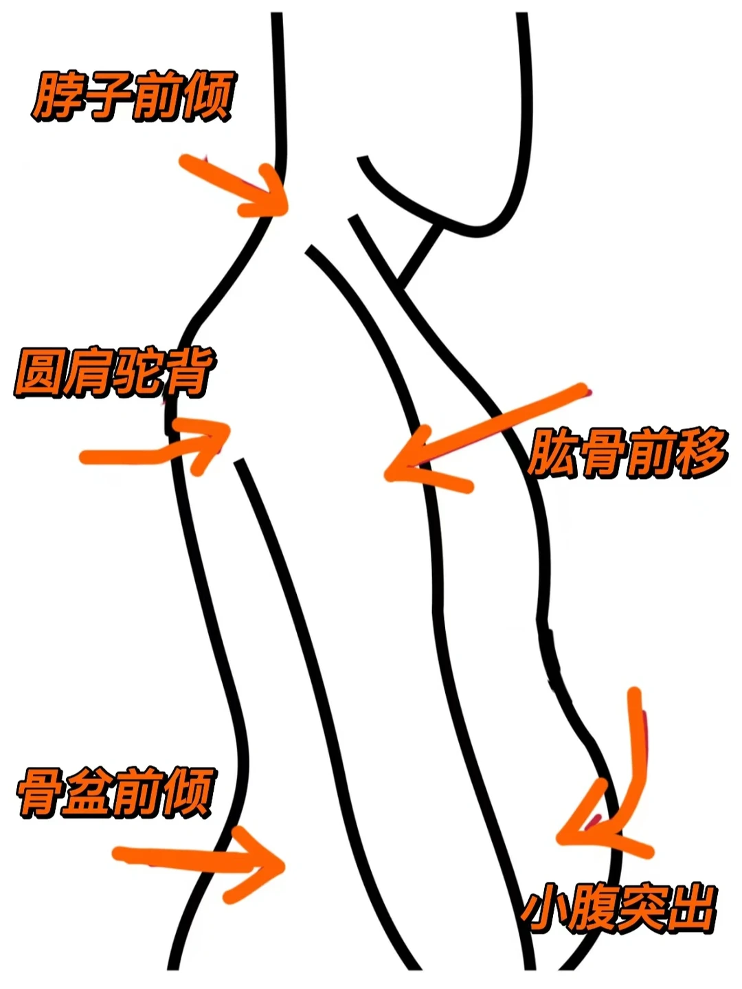 每天必练的开肩动作！不允许你不知道！