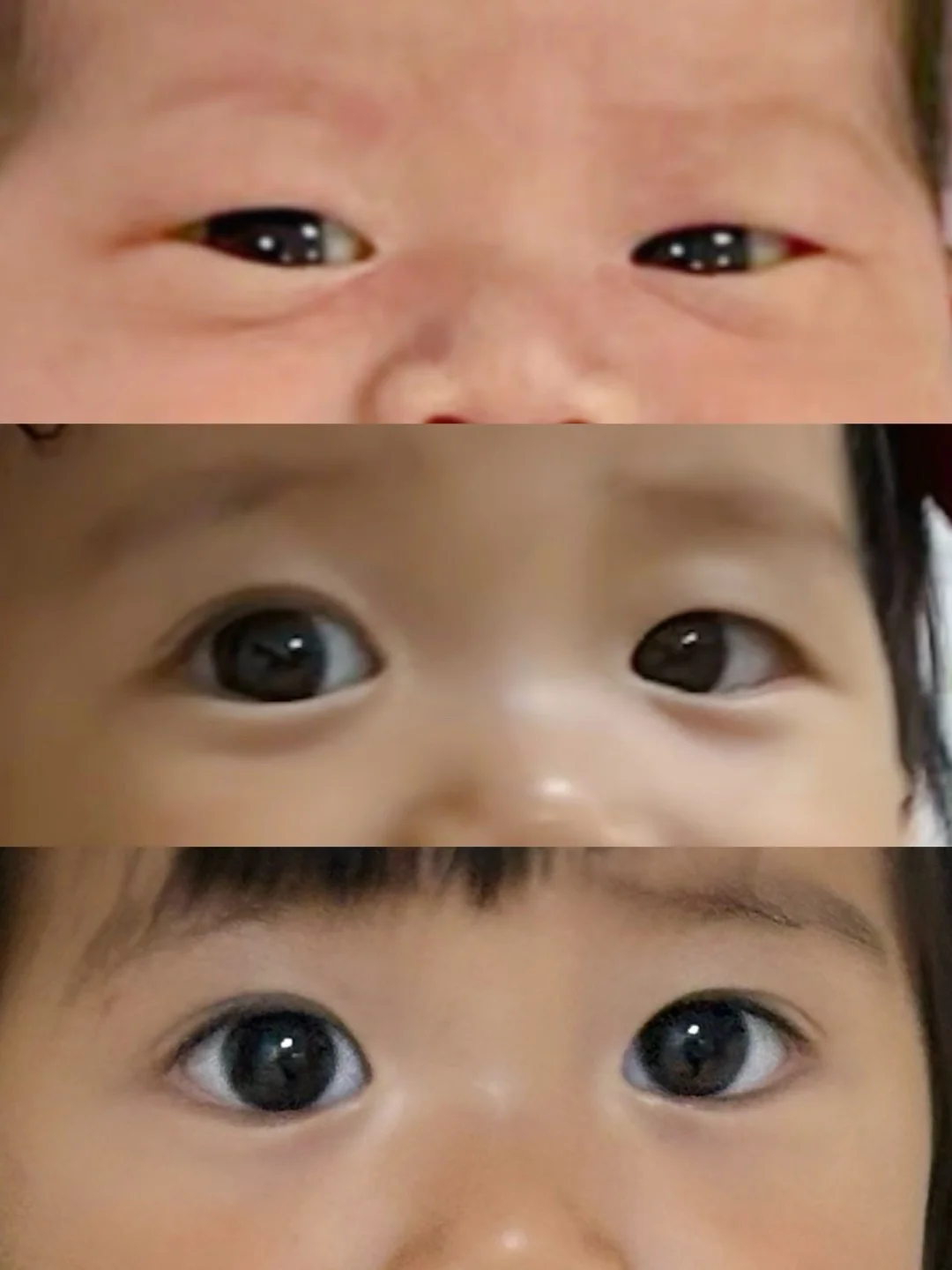 终于！大眼逆袭！悲伤蛙➡️大小眼➡️圆圆大眼睛