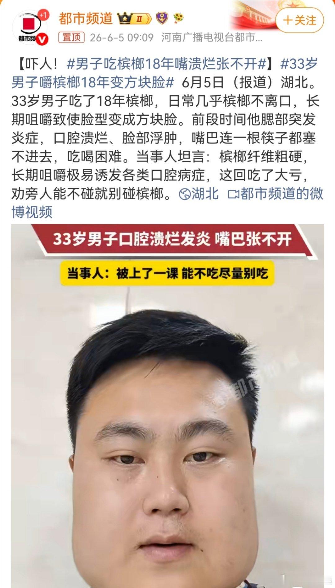 食用槟榔采用幼果，药用槟榔采用成熟的槟榔果实；食用槟榔大量使用各种添加...