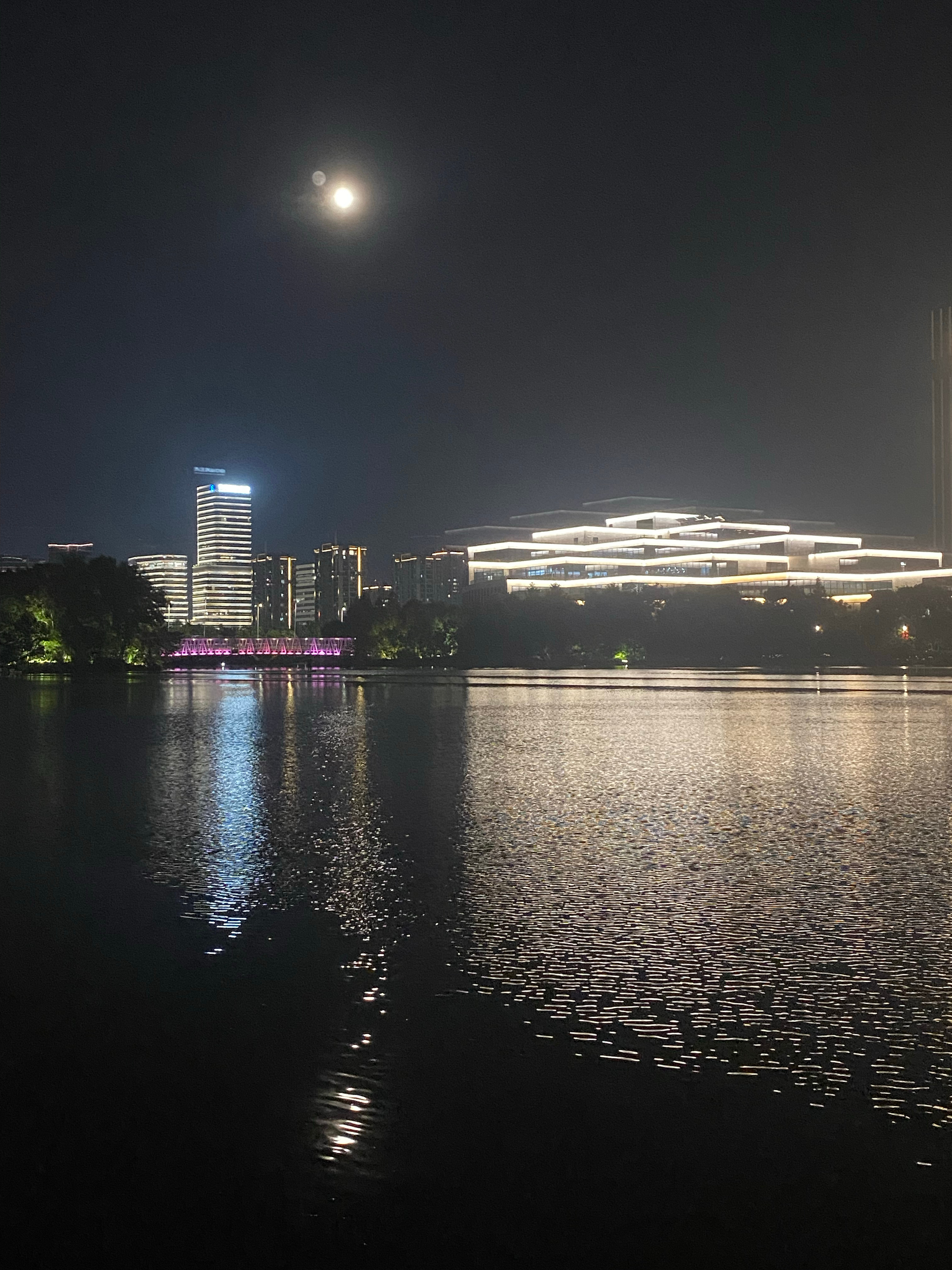 温州一名49岁务工男子因输尿管结石剧痛深夜输液后，在留观室用仪器电线自缢身亡，家属称其此前毫无轻生倾向，推测是剧痛难忍导致悲剧，但一审法院已驳回家属86万元索赔。  一、家属说法与悲剧经过- 无预兆：