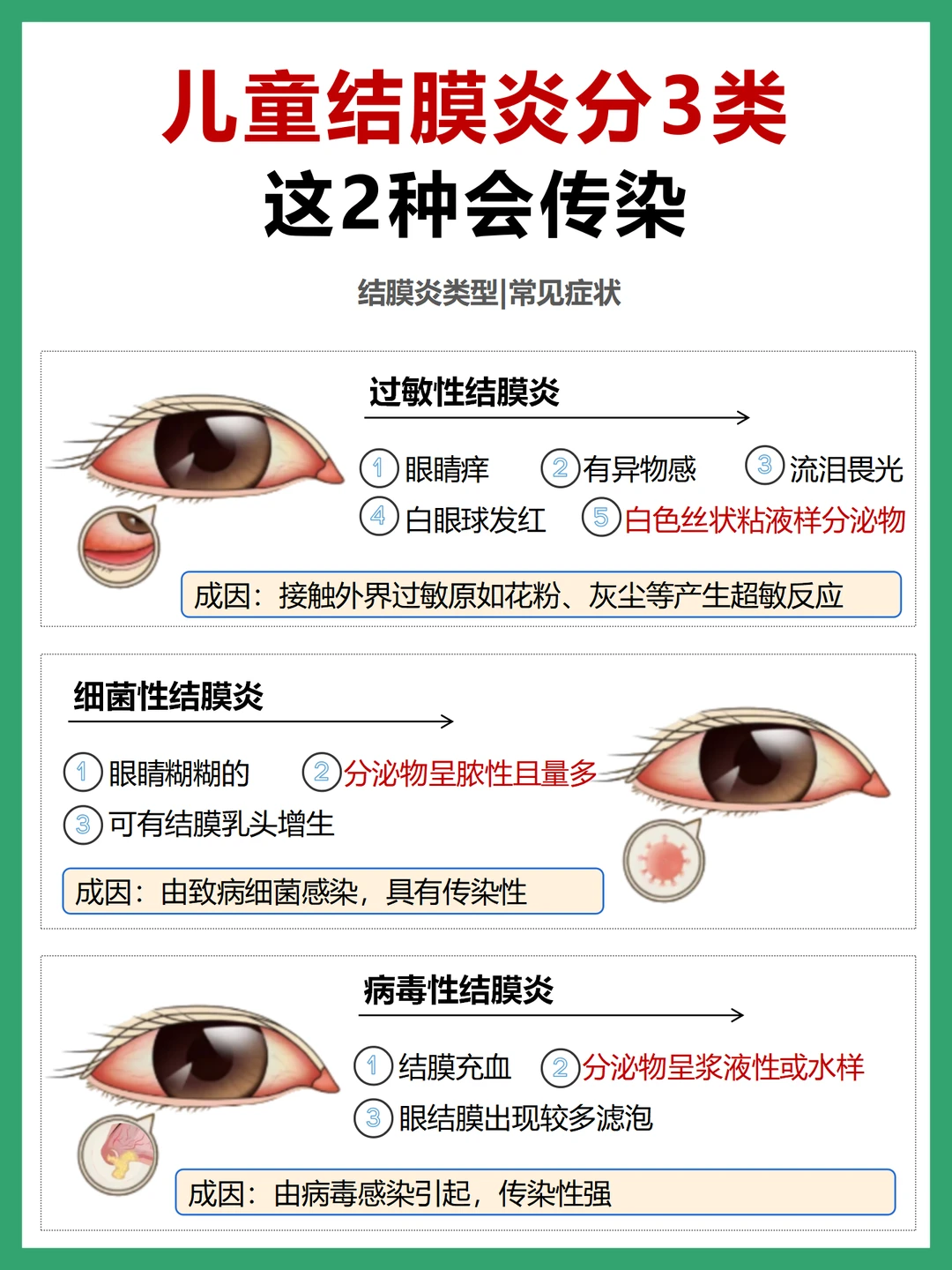 为什么没人把儿童结膜炎这件事情讲清楚啊
