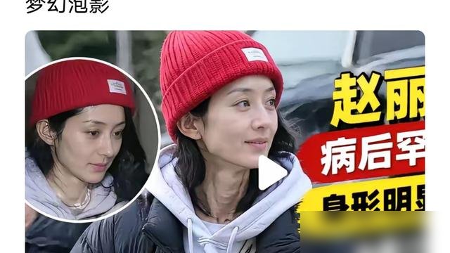 赵丽颖瘦到脱相，一个人坐观众席看谢娜的话剧，身边连个助理都没跟着。
白T恤牛仔裤，裹了条红披肩，瘦得锁骨都支棱出来了。8月那场低血糖加电解质紊乱，差点没把人送走。这才缓过来几天，没进组，没跑通告，就窝在家里看剧本。
可你看她给谢娜送的花篮，卡片上写的是“祝大哥，演出成功”。病成那样，还记得谢娜爱